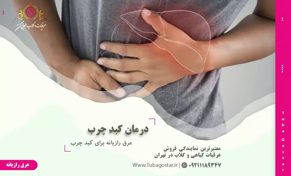عرق رازیانه برای کبد چرب