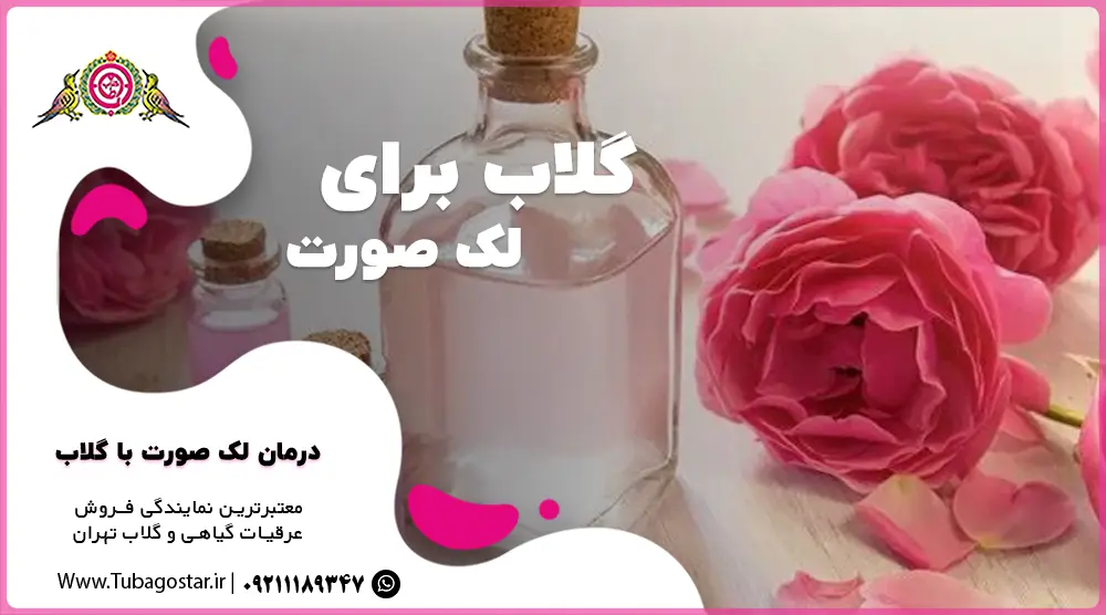 خواص گلاب برای لک صورت